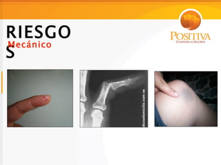 RIESGO
Mecánico
S
 