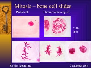 Mitosis – bone cell slides 2 4 5 Parent cell Chromosomes copied Copies separating 2 daughter cells Cells split 