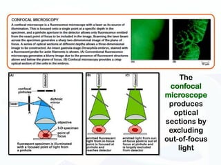 The
 confocal
microscope
 produces
  optical
sections by
 excluding
out-of-focus
    light
 