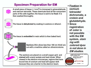 Specimen Preparation for EM    Fixation in
                                osmium
                                tetroxide/
                                dichromate, a
                                crolein and
                                glutaldehyde.
                               Since
                                registration
                                of color is
                                not possible
                                with the EM
                                system, stain
                               ing with
                               colored dyes
                               is not done in
                               EM studies.
 