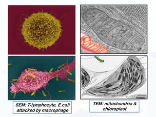 SEM: T-lymphocyte, E.coli   TEM: mitochondria &
attacked by macrophage          chloroplast
 