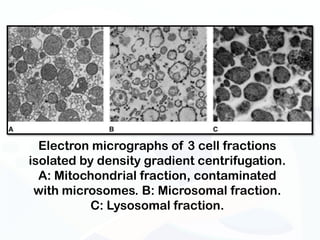 Electron micrographs of 3 cell fractions
isolated by density gradient centrifugation.
  A: Mitochondrial fraction, contaminated
 with microsomes. B: Microsomal fraction.
           C: Lysosomal fraction.
 