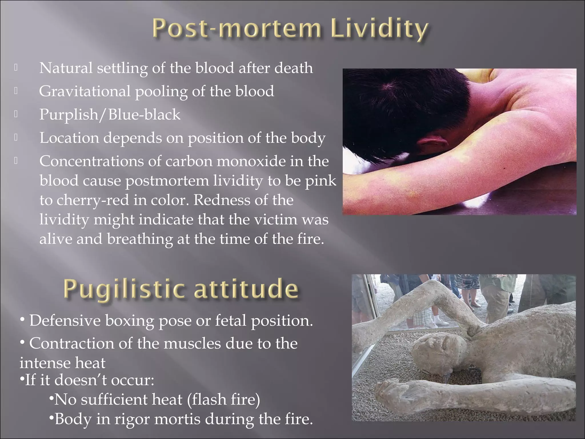      Natural settling of the blood after death
     Gravitational pooling of the blood
     Purplish/Blue-black
     Location depends on position of the body
     Concentrations of carbon monoxide in the
      blood cause postmortem lividity to be pink
      to cherry-red in color. Redness of the
      lividity might indicate that the victim was
      alive and breathing at the time of the fire.




    • Defensive boxing pose or fetal position.
    • Contraction of the muscles due to the
    intense heat
    •If it doesn’t occur:
          •No sufficient heat (flash fire)
          •Body in rigor mortis during the fire.
 