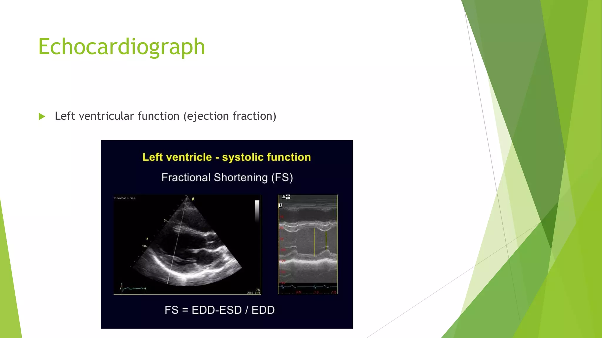 Echocardiograph
 Left ventricular function (ejection fraction)
 
