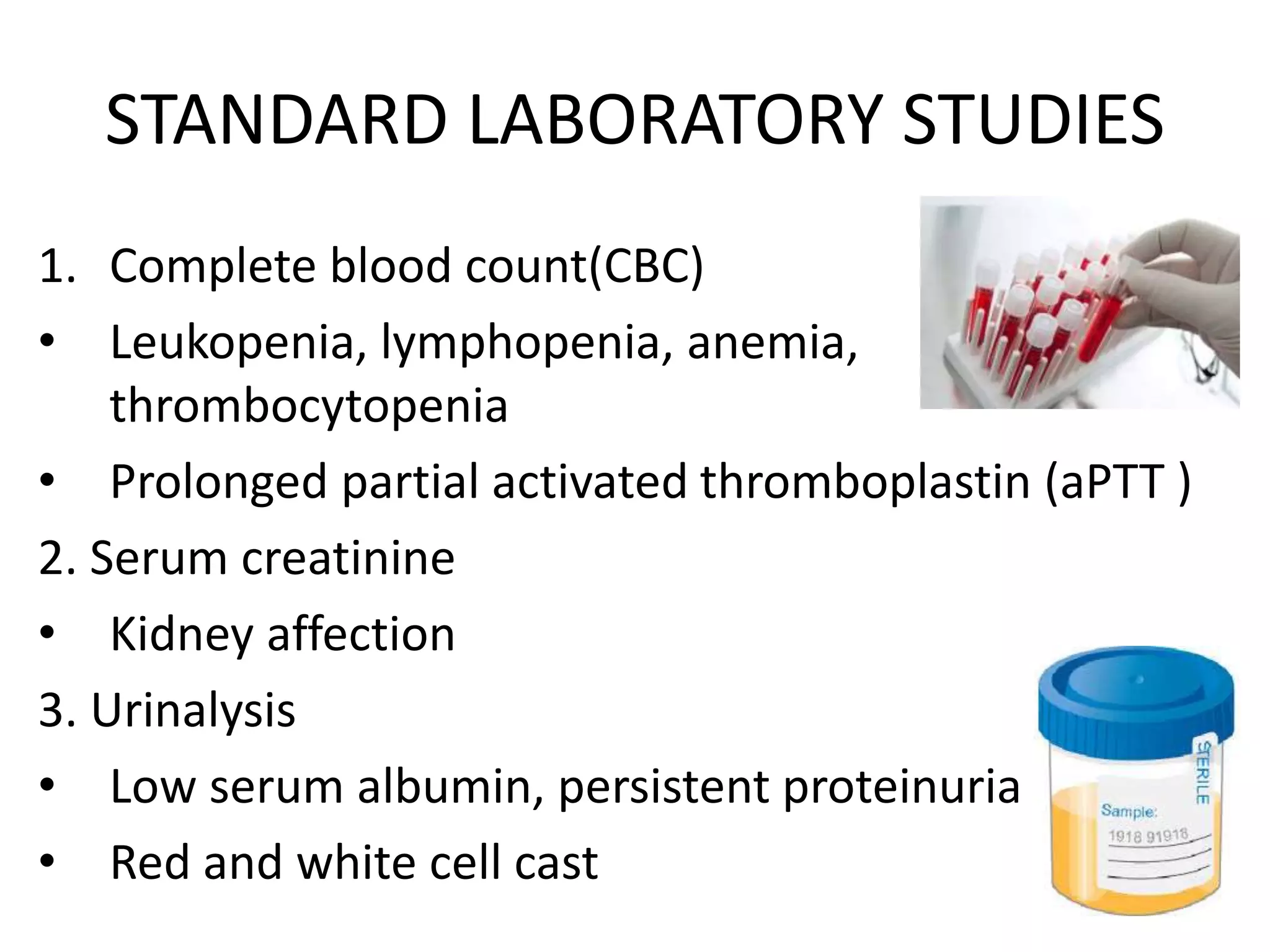 Investigation of systemic lupus erythematosus (sle) | PPTX