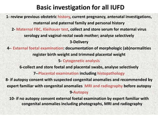 Investigations for iufd & sb, how to select? | PPTX