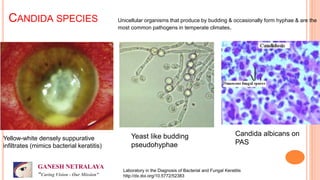 Investigations in a case of corneal ulcer in a clinic setting what to ...