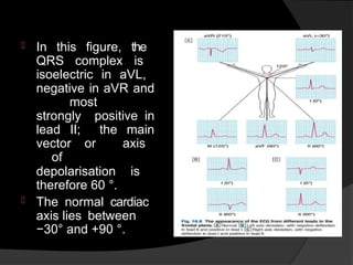 Comprehensive Overview of Cardiac Diagnostic Techniques and ECG ...