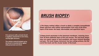 INVESTIGATIONS OF ORAL CANCER ramsha 4 (1).pdf