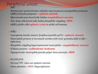 Peripheral smear
 RBC-
 Normocytic normochromic with few macrocytes,no anisopoikilocytosis,no
  nRBCs,reticulocytopenia----aplastic anemia
 Macroovalocytes,howel jolly bodies-megaloblastic anemia
 Tear drop cells,howel jolly bodies,basophilic stippling--MDS
 nRBCs,sickle cells-aplastic crisis in sickle cell anemia


 WBC-
 Leucopenia,mostly mature lymphocytyes(80-90%)---aplastic anemia
 Neutrophils present in increased number,with toxic granules,shift to left—
  infections
 Basophilic stippling,hypersegmented neutrophils—megaloblastic anemia
 If blasts present—subleukemic leukemia
 Hypogranular neutrophils,pseudo pelger heut anomaly--MDS


 PLATELETS-
 Normal TPC rules out aplastic anemia
 Giant platelets—MDS /hypersplenism
 