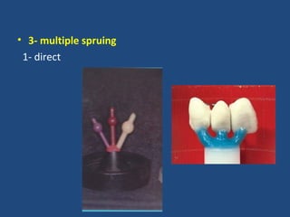 • 3- multiple spruing
1- direct
 