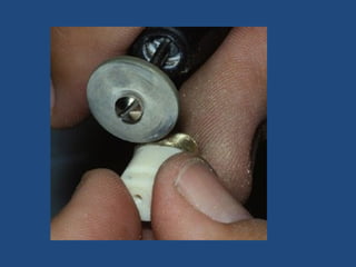 Investing and casting