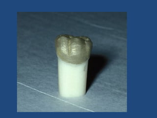 Investing and casting