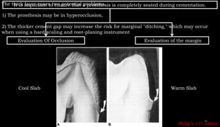 CEMENTATION OF INLAY AND VARIOUS TECHNIQUE FOR TEMPORIZATION | PPTX
