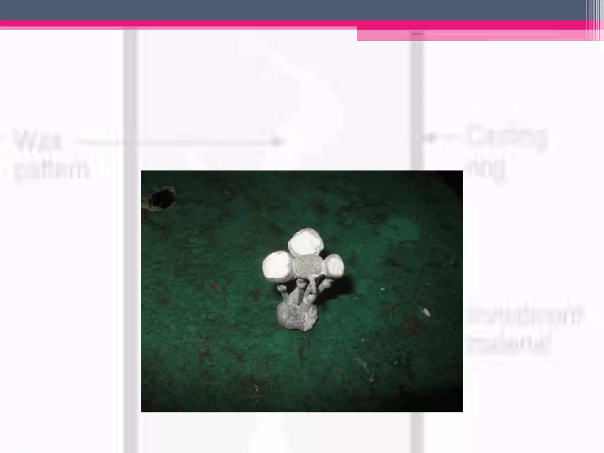 Investment materials