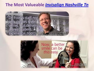 Invisalign | PDF