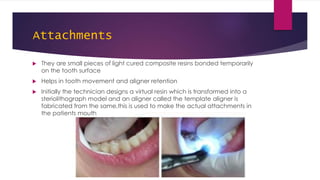 Invisalign | PPTX