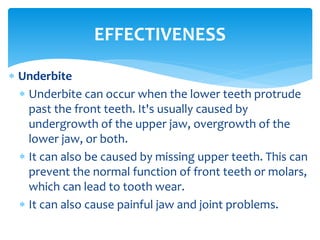  Underbite
 Underbite can occur when the lower teeth protrude
past the front teeth. It's usually caused by
undergrowth of the upper jaw, overgrowth of the
lower jaw, or both.
 It can also be caused by missing upper teeth. This can
prevent the normal function of front teeth or molars,
which can lead to tooth wear.
 It can also cause painful jaw and joint problems.
EFFECTIVENESS
 