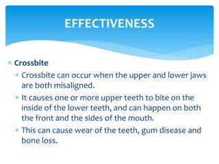 Crossbite
 Crossbite can occur when the upper and lower jaws
are both misaligned.
 It causes one or more upper teeth to bite on the
inside of the lower teeth, and can happen on both
the front and the sides of the mouth.
 This can cause wear of the teeth, gum disease and
bone loss.
EFFECTIVENESS
 