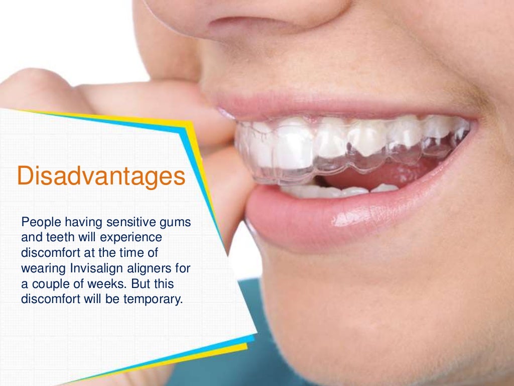 Invisalign Braces Advantages and Disadvantages