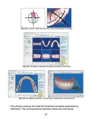 Invisalign Care Instructions.pdf invisalign in orthodontic treatments .PDF