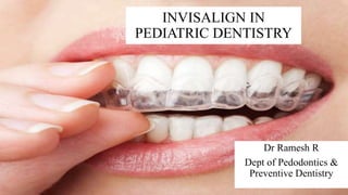 INVISALIGN IN
PEDIATRIC DENTISTRY
Dr Ramesh R
Dept of Pedodontics &
Preventive Dentistry
 