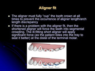invisalign Pereperd by dr.abdulghani ,Aloulefi .Alhaddad.ppt