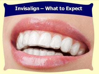 Invisalign – What to Expect
 