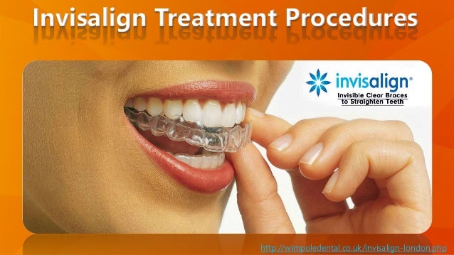 Invisalign Treatment Procedures Get Straight Teeth