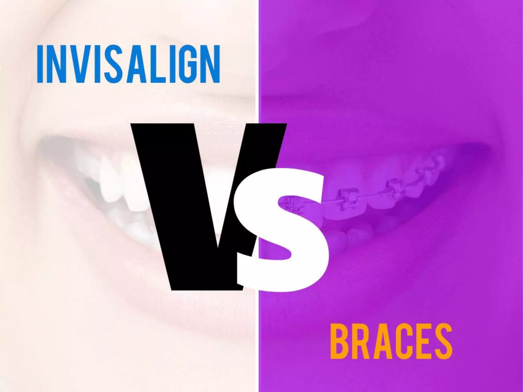 Invisalign vs Braces PPT