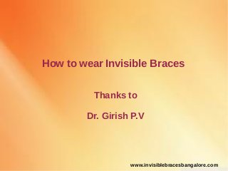 How to wear Invisible Braces
Thanks to
Dr. Girish P.V
www.invisiblebracesbangalore.com
 