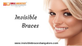  Invisible
      Braces
www.invisiblebracesbangalore.com
 