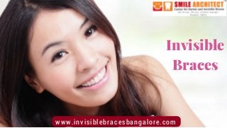 Invisible
Braces
www.invisiblebracesbangalore.com
 