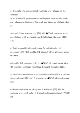 (a) Example of a conventional electrode array placed on the
subdural
cortex (top) with post-operative radiograph showing electrode
array placement (bottom). The pitch and diameter of electrodes
are
1 cm and 2 mm, respectively [20]. (b) �ECoG electrode array
placed along with a conventional ECoG electrode array [21],
[22].
(c) Patient-specific electrode array for sulcal and gyral
placement [23]. (d) Flexible 252-channel ECoG electrode array
on a thin
polyimide foil substrate [24]. (e) �ECoG electrode array with
124 circular electrodes with three different diameters [25].
(f) Parylene-coated metal tracks and electrodes within a silicone
rubber substrate [26]. (g) A transparent �ECoG electrode array
with
platinum electrodes on a Parylene C substrate [27]. (h) An
electrode array with poly (3, 4-ethylenedioxythiophene) (PDOT)
and
 