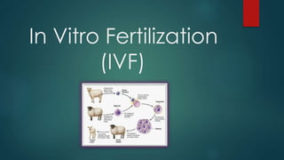 In Vitro Fertilization
(IVF)
 