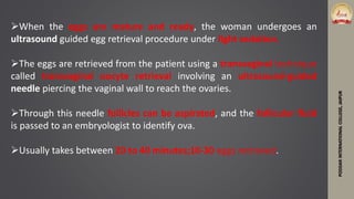 PODDARINTERNATIONALCOLLEGE,JAIPUR
When the eggs are mature and ready, the woman undergoes an
ultrasound guided egg retrieval procedure under light sedation.
The eggs are retrieved from the patient using a transvaginal technique
called transvaginal oocyte retrieval involving an ultrasound-guided
needle piercing the vaginal wall to reach the ovaries.
Through this needle follicles can be aspirated, and the follicular fluid
is passed to an embryologist to identify ova.
Usually takes between 20 to 40 minutes;10-30 eggs retrieved.
 