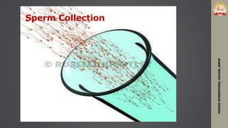 Sperm Collection
PODDARINTERNATIONALCOLLEGE,JAIPUR
 