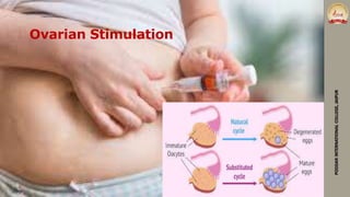 Ovarian Stimulation
PODDARINTERNATIONALCOLLEGE,JAIPUR
 