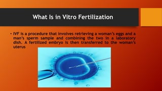 What Is in Vitro Fertilization
• IVF is a procedure that involves retrieving a woman’s eggs and a
man’s sperm sample and combining the two in a laboratory
dish. A fertilized embryo is then transferred to the woman’s
uterus
 