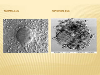 NORMAL EGG   ABNORMAL EGG
 
