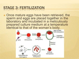 STAGE 3: FERTILIZATION
   Once mature eggs have been retrieved, the
    sperm and eggs are placed together in the
    laboratory and incubated in a meticulously
    prepared culture medium at a temperature
    identical to that of the woman’s body.
 