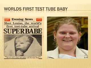 WORLDS FIRST TEST TUBE BABY
 
