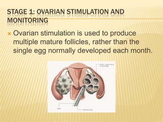 STAGE 1: OVARIAN STIMULATION AND
MONITORING
   Ovarian stimulation is used to produce
    multiple mature follicles, rather than the
    single egg normally developed each month.
 