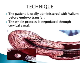 In vitro fertilization and embryo transfer in humans | PPTX