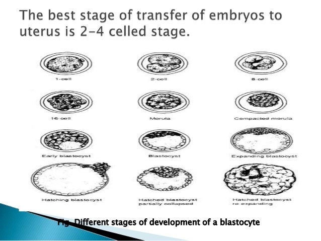embryo transfer