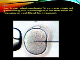 ICSI
Stands for intra-cytoplasmic sperm injection. This process is used to inject a single
sperm into each egg before the fertilized eggs are put back into the woman's body.
The procedure may be used if the male has a low sperm count.
 