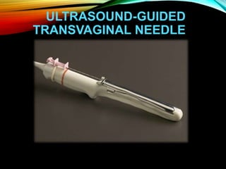 ULTRASOUND-GUIDED
TRANSVAGINAL NEEDLE
 