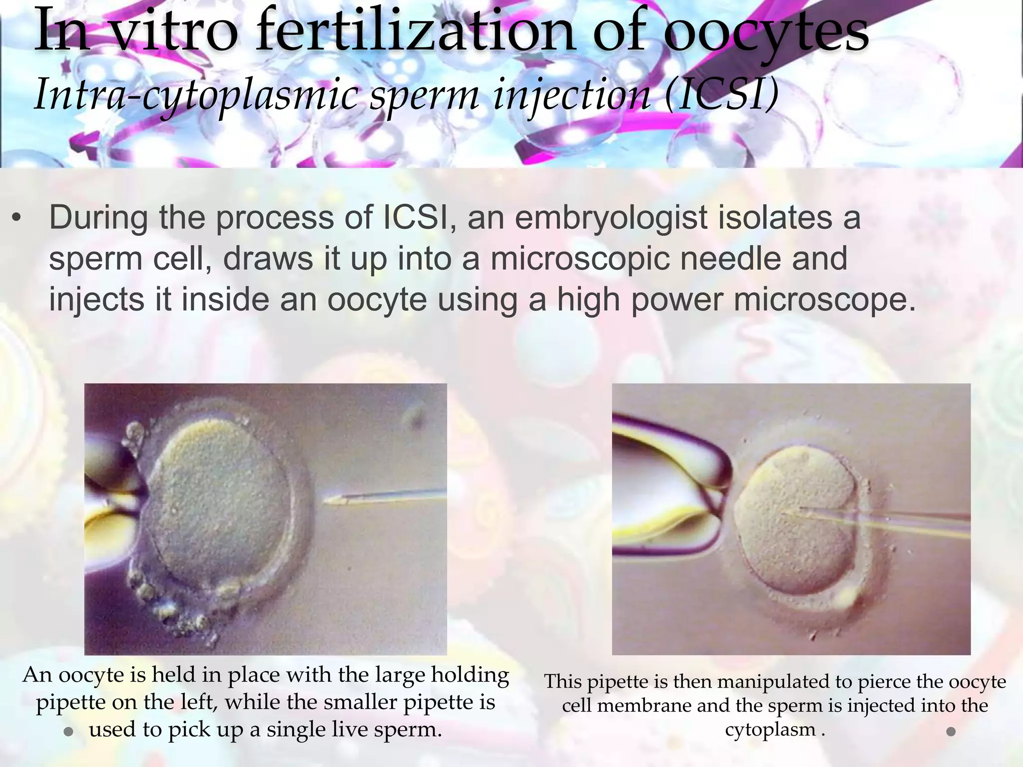 In vitro fertilization methods | PPTX