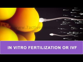 IN VITRO FRETILIZATION
OR
IVF
 