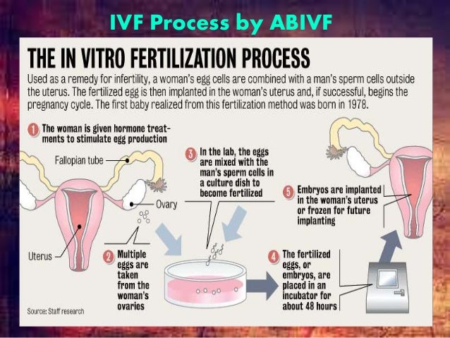 In vitro fertilization process by alta bates